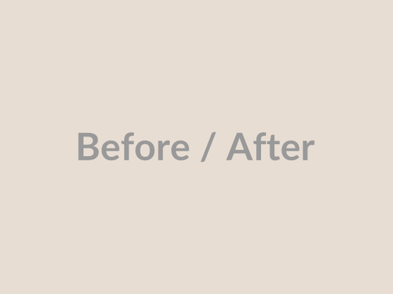 Skincare Home - Before / After